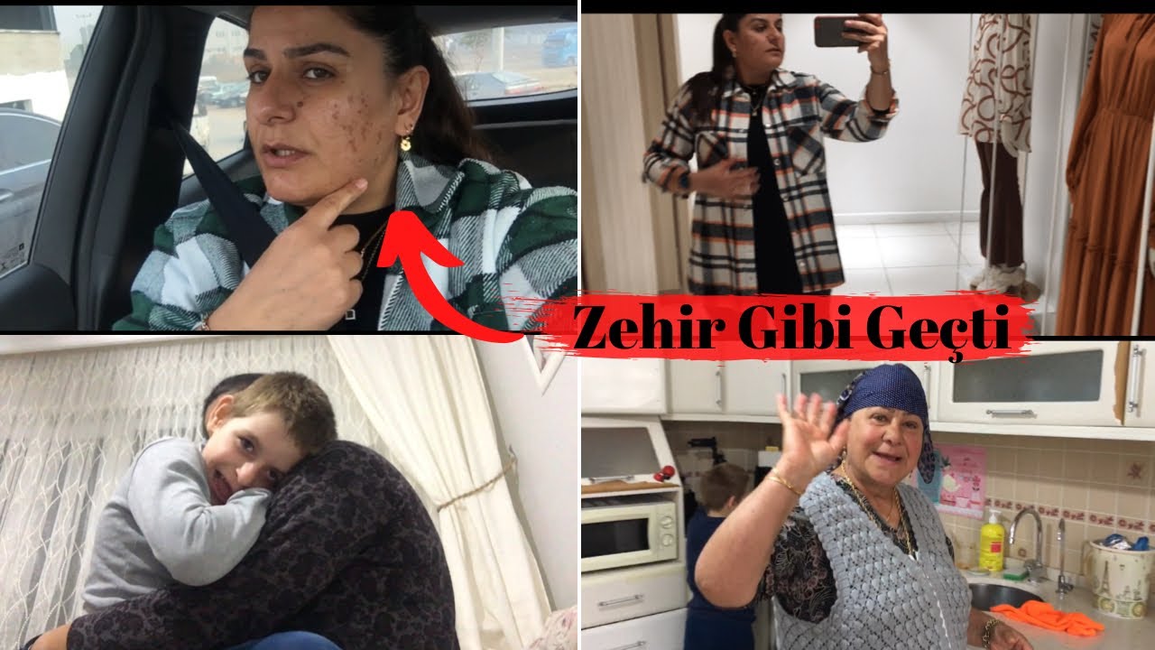 AMELİYAT OLMA İHTİMALİM ÇOK YÜKSEK 😰 KORKUYORUM 😔 DOKTOR NE DEDİ 😕 YÜZÜME NE OLDU BÖYLE ❗️