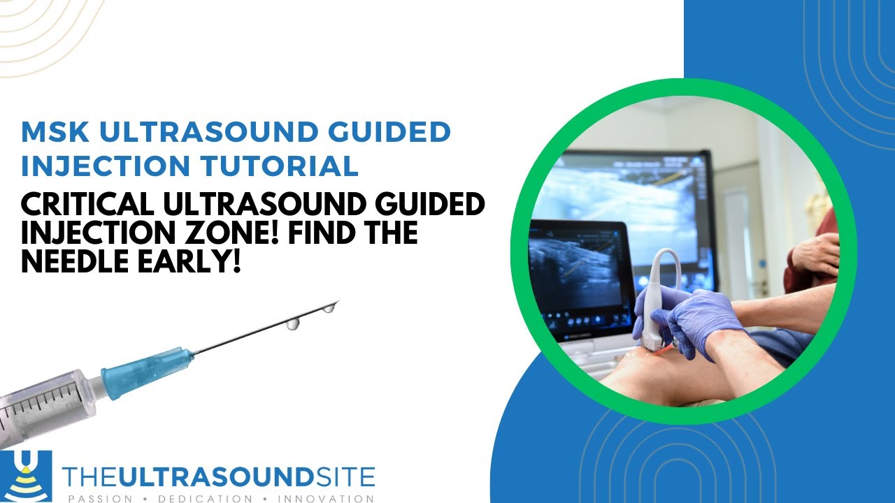 Critical ultrasound guided injection zone! Find the needle early!