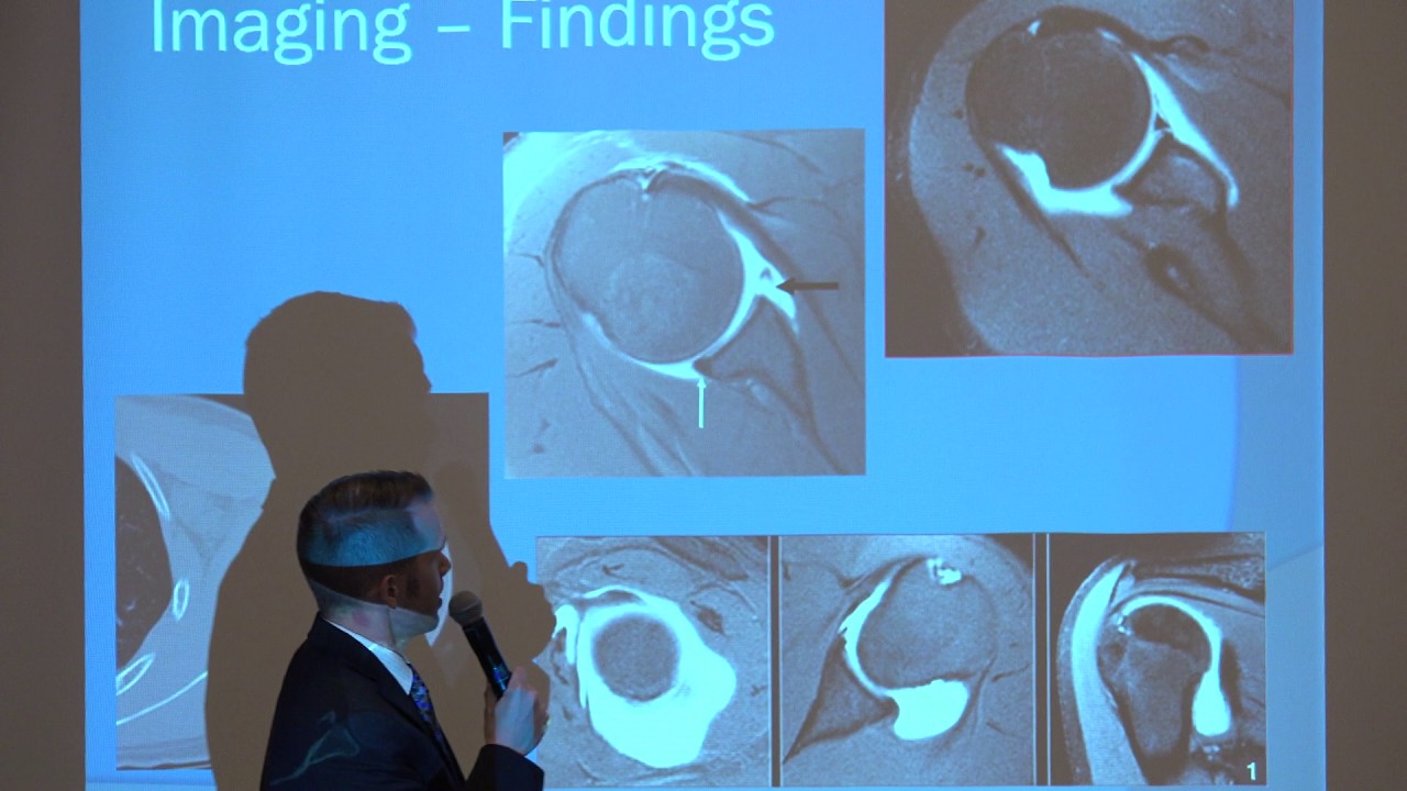 NWI Dr John Guzzo Orthopedic Surgeon Discusses Shoulder Labral Tears and Repair