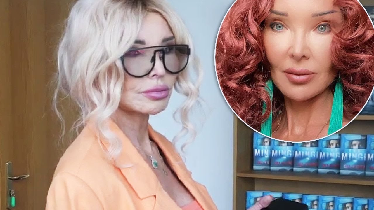 Ewa Minge pierwszy raz tak szczerze o operacjach plastycznych i batalii sądowej z chirurgiem