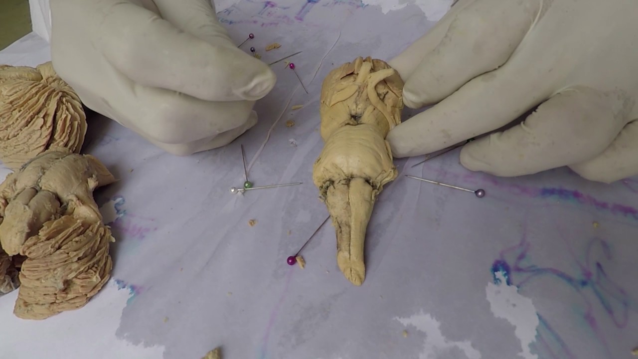 Neuroanatomia Rinco: Bulbo Raquídeo o Médula Oblongada.