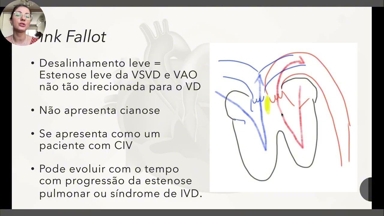 Tetralogia de Fallot - explicação completa