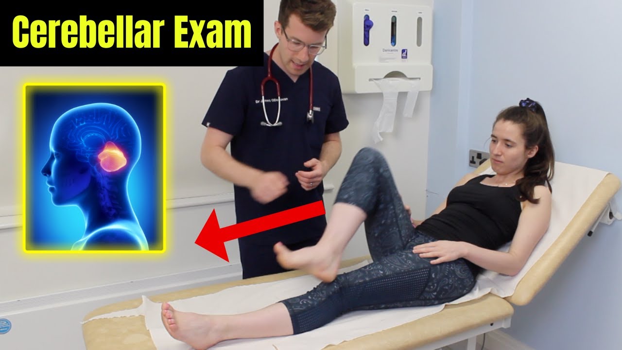 How to perform a CEREBELLAR EXAMINATION | OSCE and Clinical Skills guide by Doctor O'Donovan