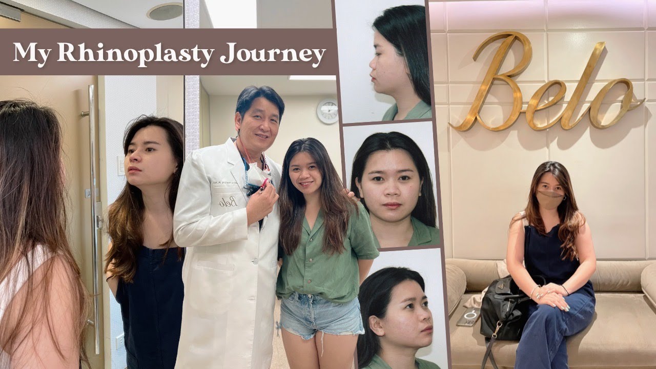 My Rhinoplasty Journey (Part 1): Made by Doctor Nato of Belo Medical Group! | Philippines