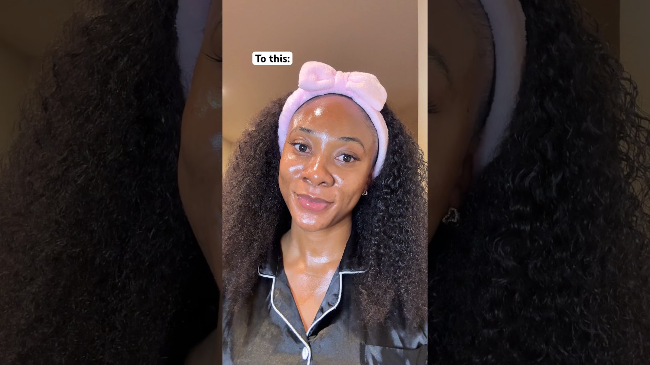 How to get rid of dark spots (hyperpigmentation hyperpigmentation #skincare #hyperpigmentation