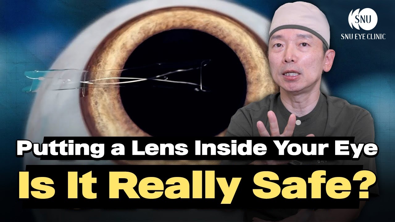 Is Lens Implant Surgery Really Safe? (ICL Explained)