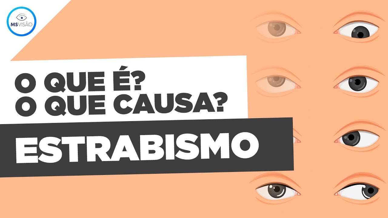 O Que É Estrabismo? E O Que Causa Estrabismo?