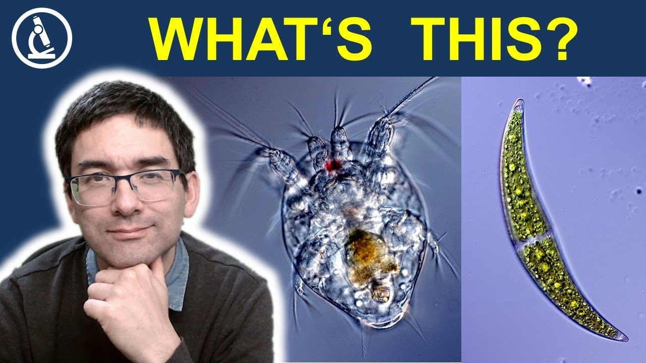 How a drop of pond water looks under the microscope 🔬 241