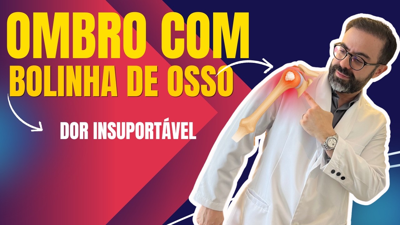 Dor súbita no ombro? Pode ser tendinite calcária! Descubra o que Fazer