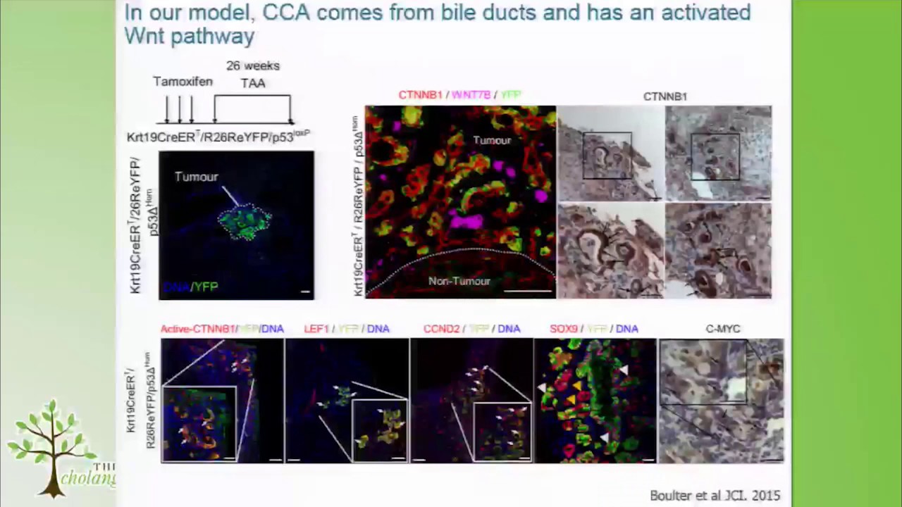 2017 CCF Annual Conference #9 - Day 2 - WNT Pathway