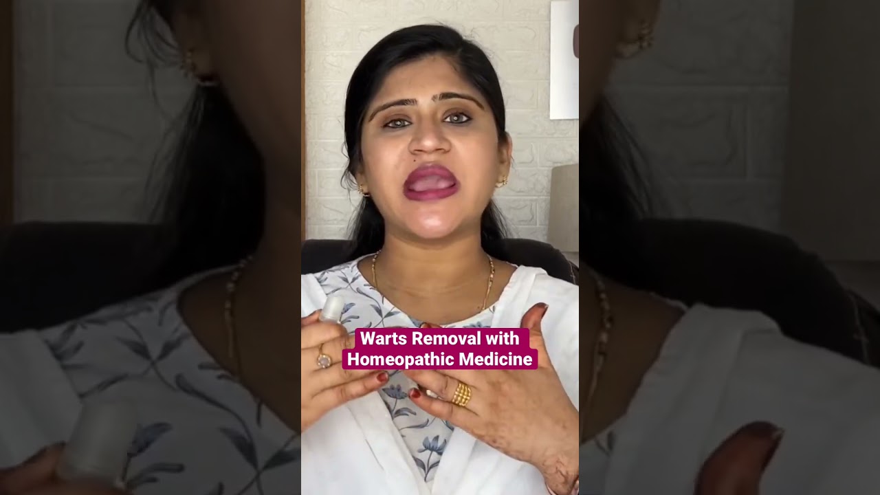 Remove warts with Homeopathic Medicine #shorts #homeopathy