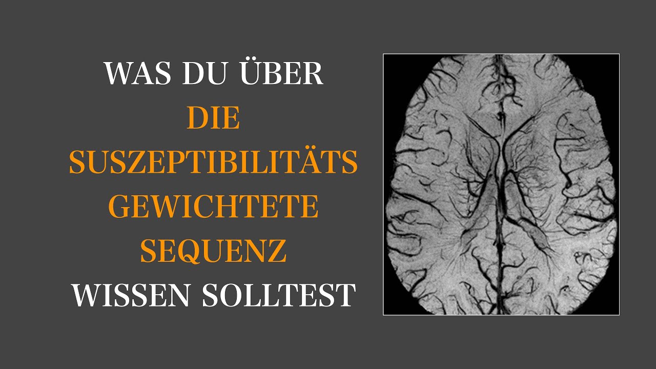 MRT Sequenzen I SWI Sequenz I Gehirn I Neuroradiologie I MRT I  4K I Brain & Synapse