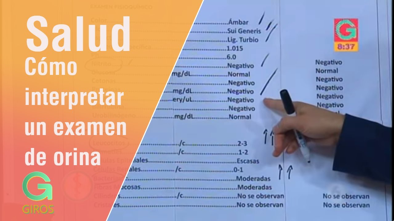 Cómo interpretar un examen de orina | Salud