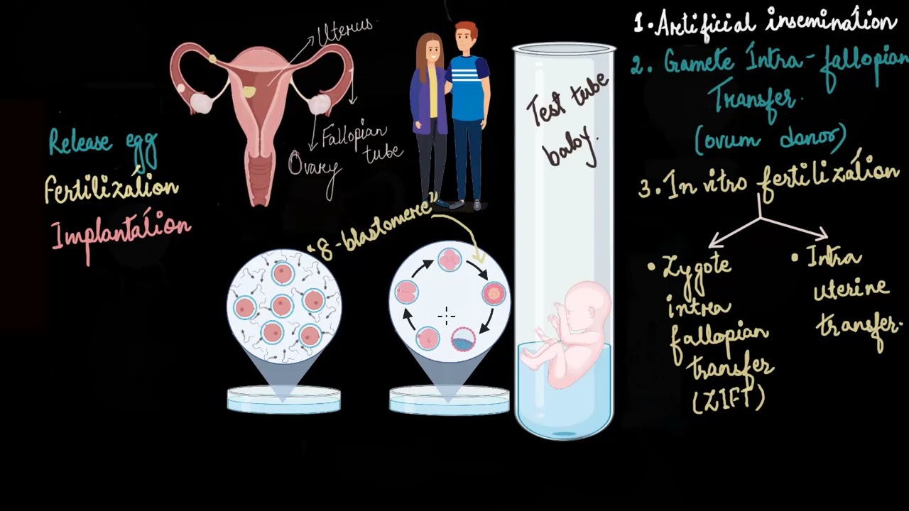In vitro fertilization and surrogacy | Reproductive health | Biology | Khan Academy