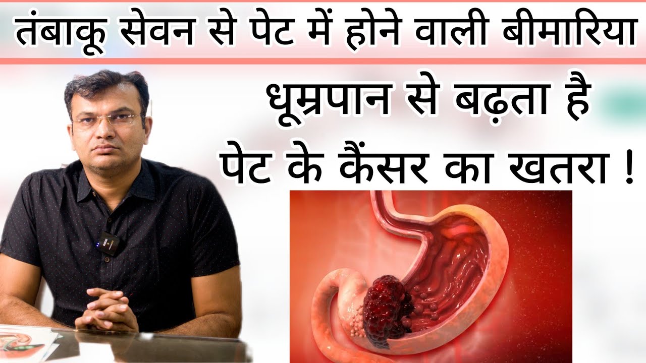 तंबाकू सेवन से पेट मे होने वाली बीमारिया  | तंबाकू खाने से पेट का कैंसर ? | Smoking & Stomach Cancer