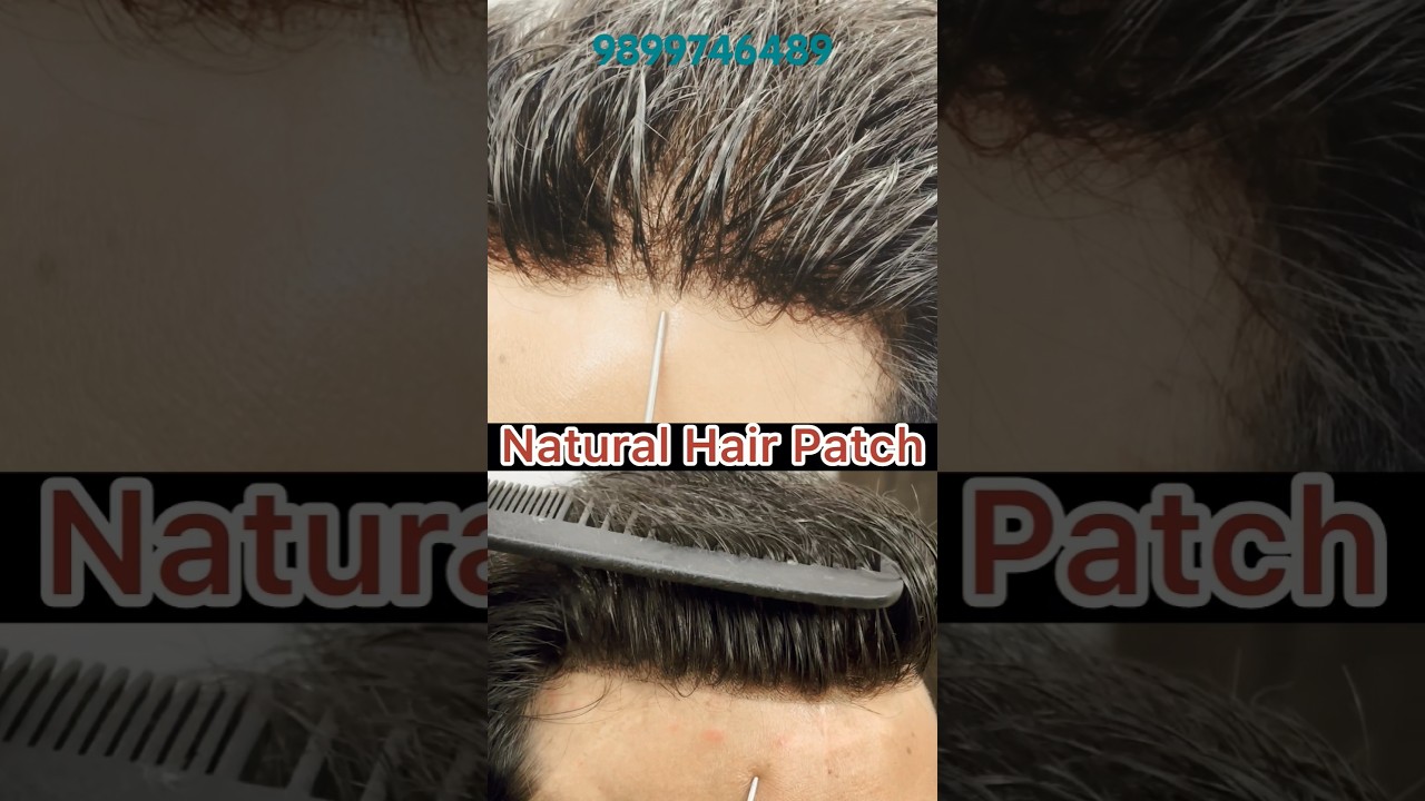 Premium Lace Hair Patch |Hair Patches for Men #hairwigsindelhi #shorts #viral #tiktok #reels #trend