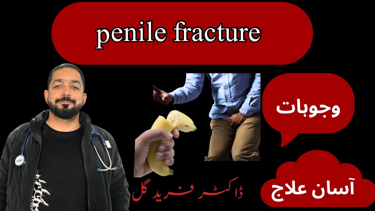 اعضائے تناسل کا زخمی ہونا اور علاج|| penile fracture treatment ||پشتو زوبان میں