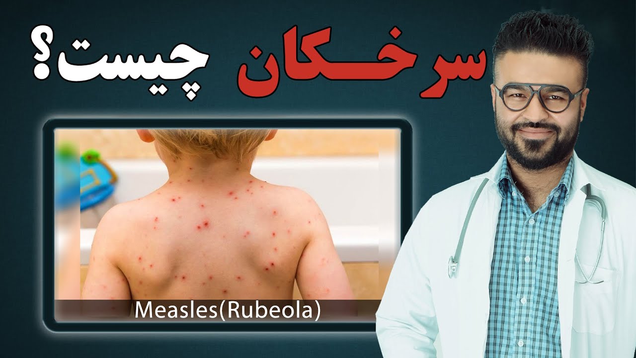 سرخکان چیست؟| داکتر قیس نیکزاد