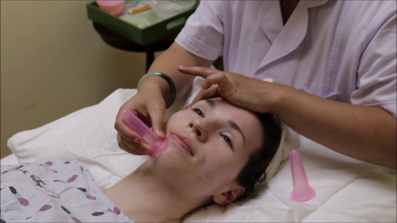Facial Cupping