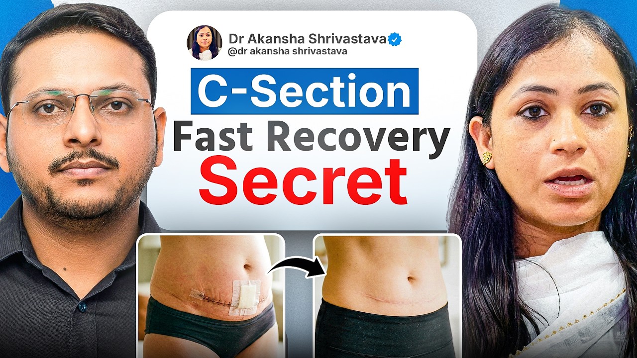 C-Section delivery ke baad kya khana chahiye, Belt kab lagani chahiye , Exercise kab shuru karein?