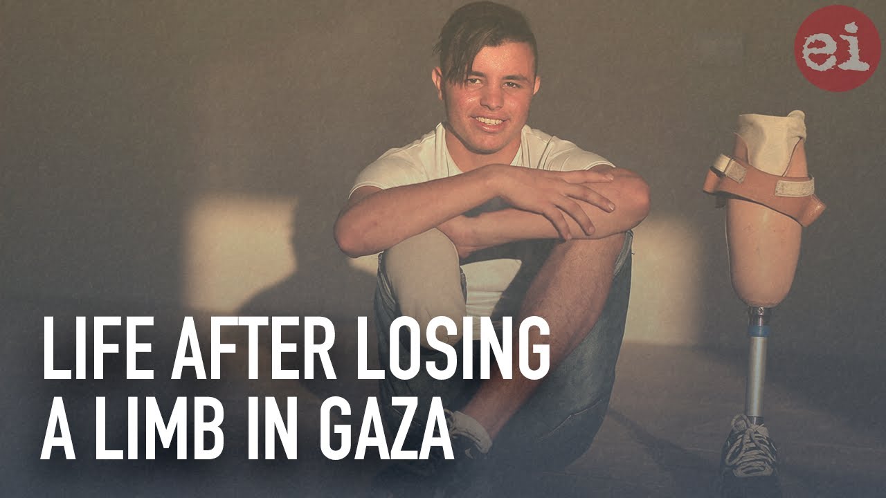 Life after losing a limb in Gaza