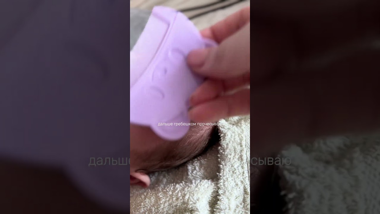Молочные корочки