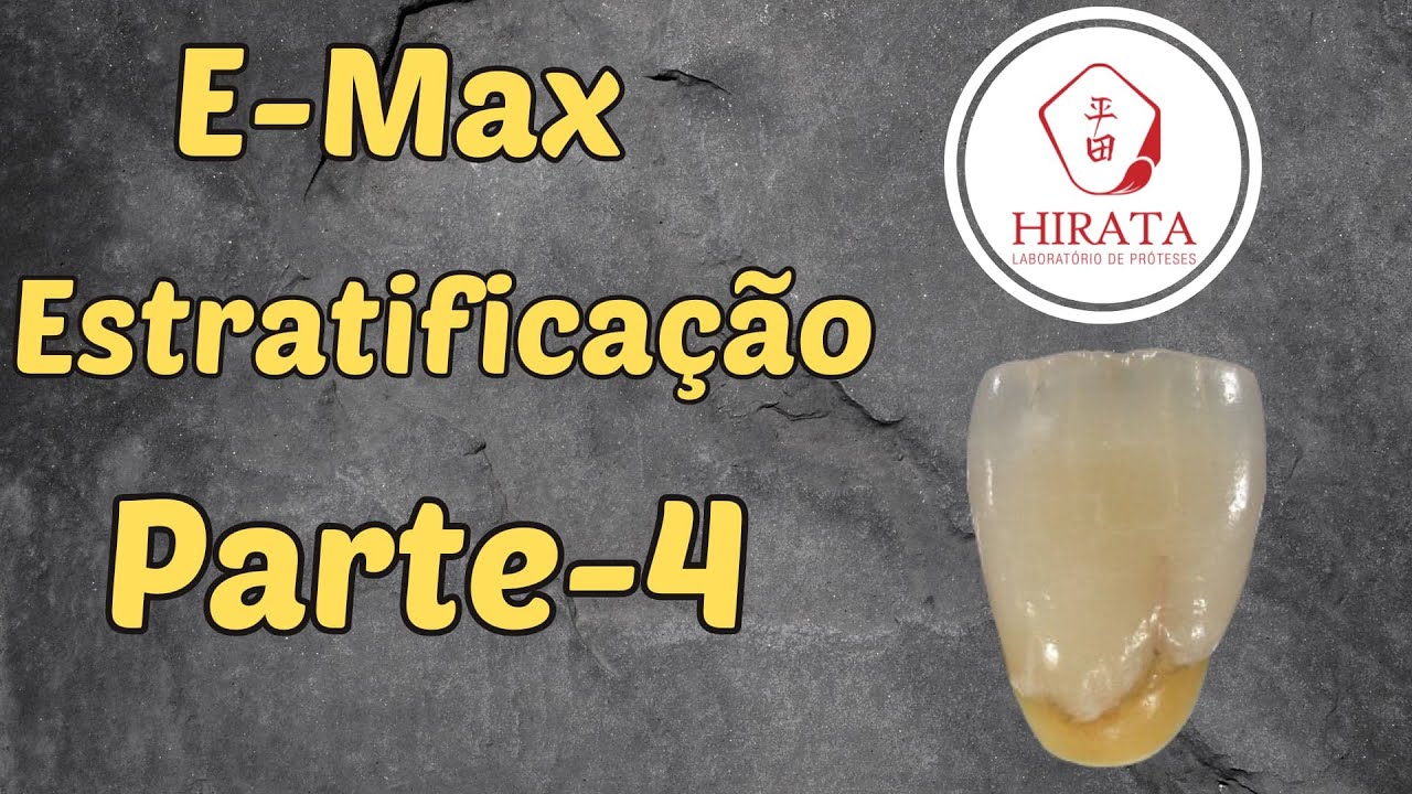 Aplicação de e-max parte 4