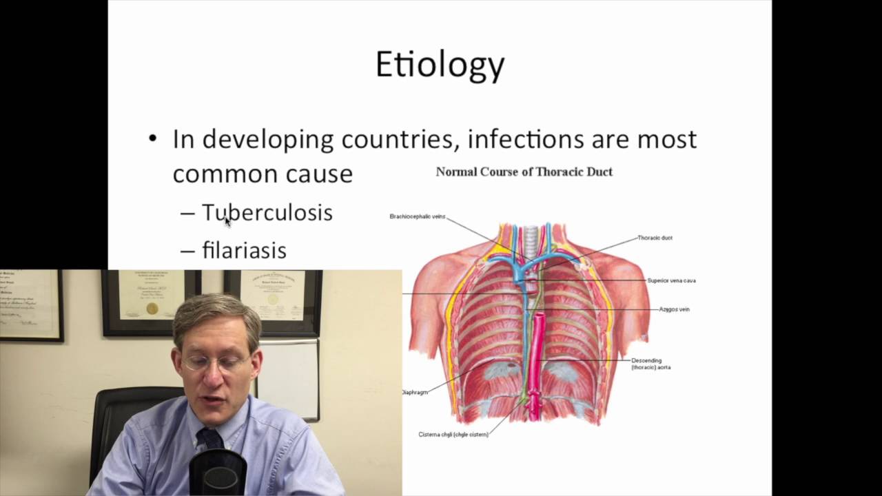 chylous ascites