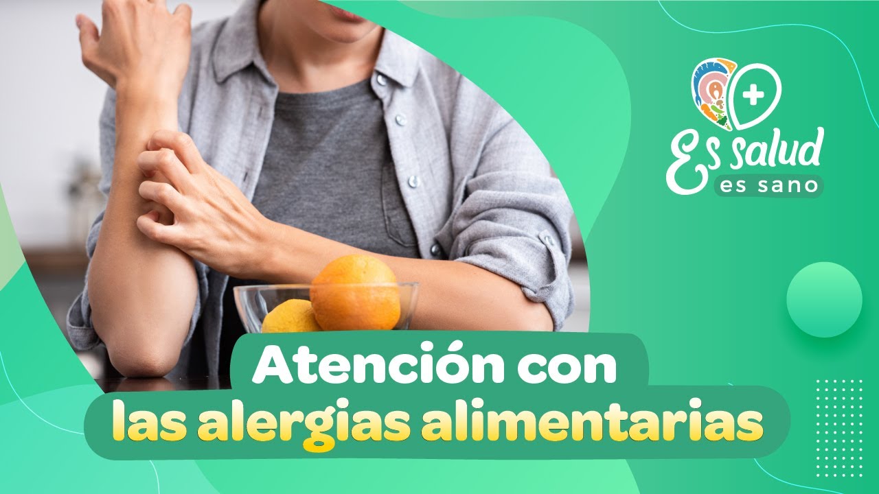 🟡 ALERGIA ALIMENTARIA: Estos son los alimentos que la podrían generar