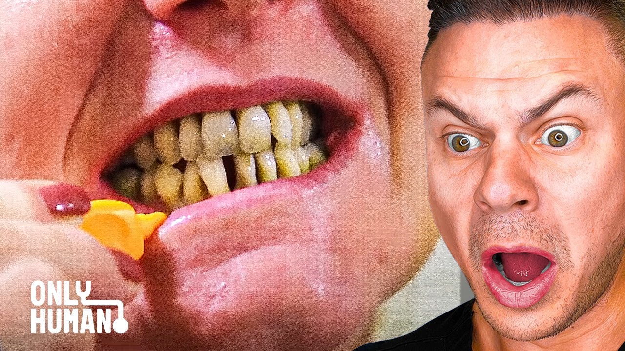 Dentist Reacts to 