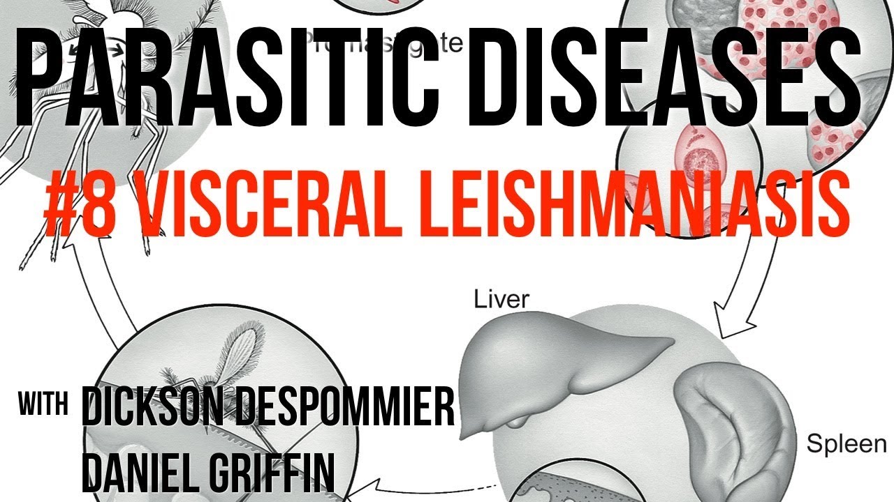 Parasitic Diseases Lectures #8: Visceral Leishmaniasis
