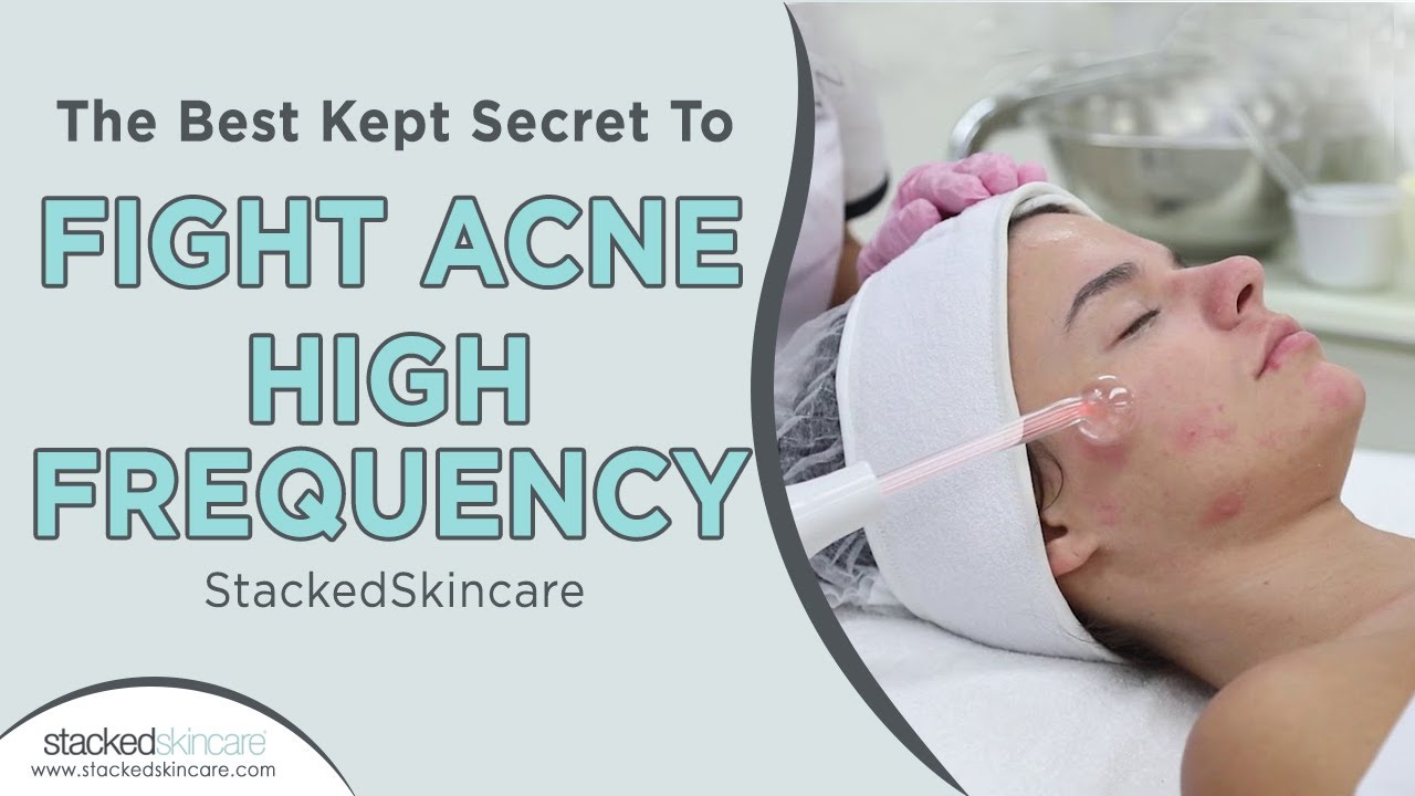 Самый тщательно охраняемый секрет борьбы с акне: высокая частота | StackedSkincare