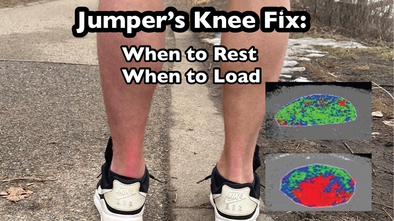 Jumper’s Knee: Resting (Fix Patellar Tendon Pain)