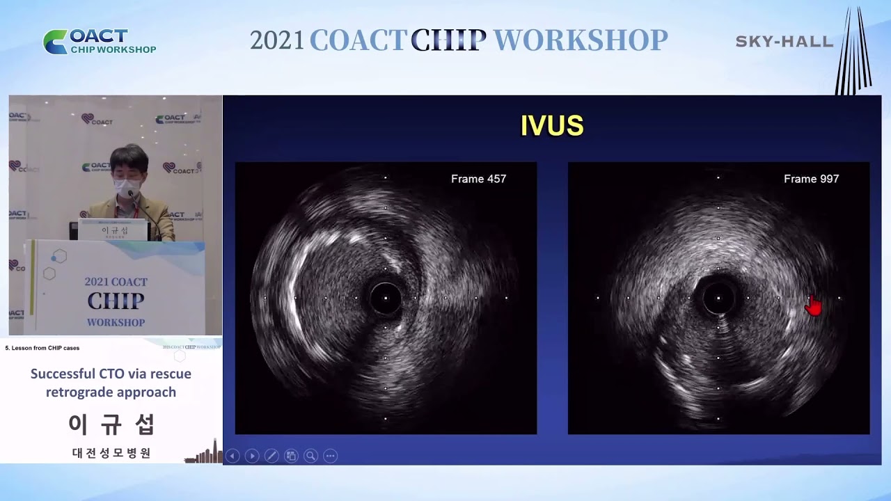 2021 COACT CHIP WORKSHOP 5 (SKY-hall) : Successful CTO via rescue retrograde approach 이규섭