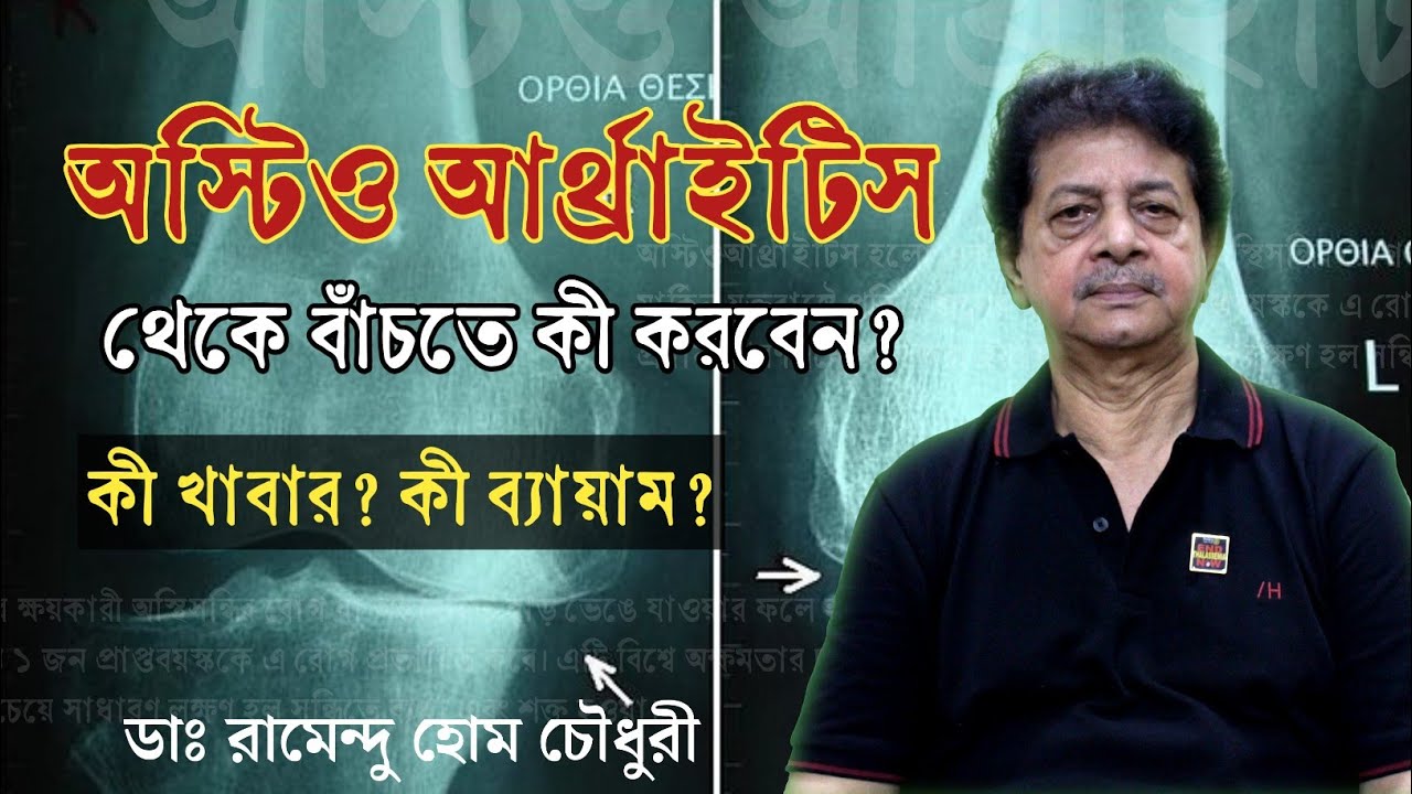 অস্টিও আর্থ্রাইটিস কী? অস্টিও আর্থ্রাইটিসের চিকিৎসা | Joint Pain & Osteoarthritis Causes & Treatment