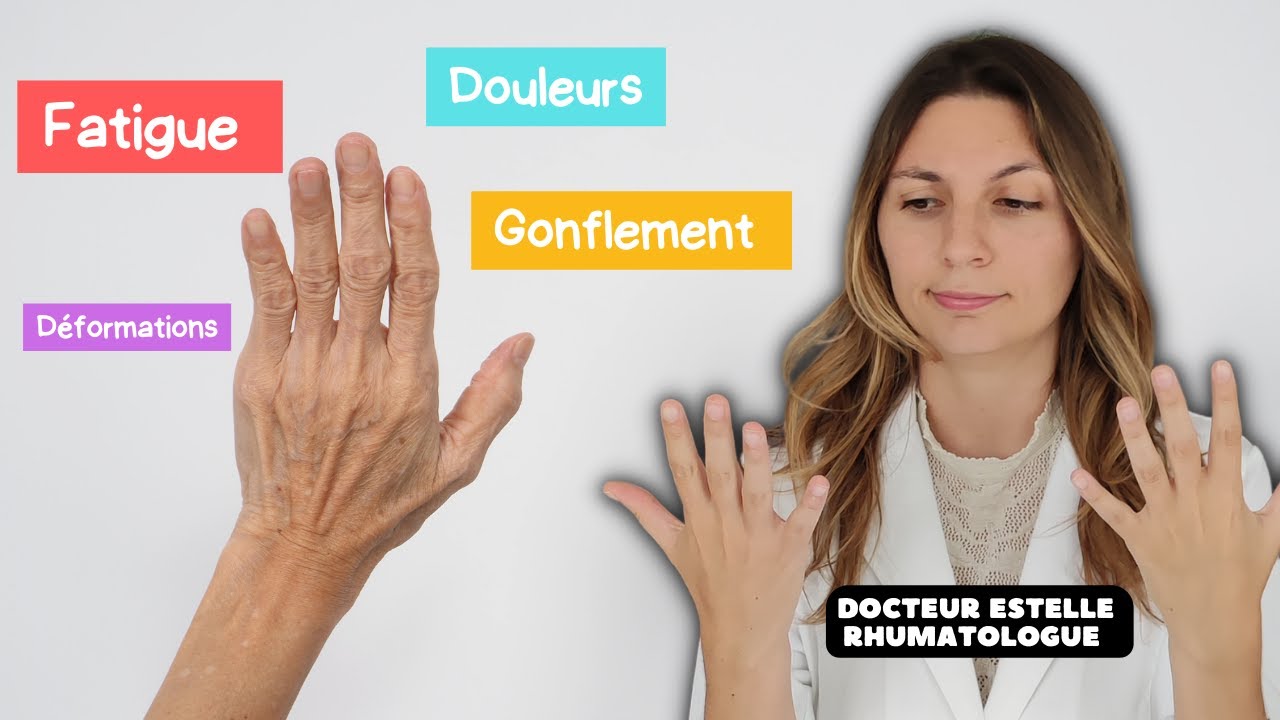 Symptômes de la polyarthrite rhumatoïde