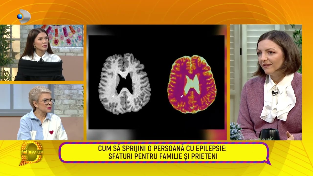 Follow us! - Dr. Irina Oane, cum se manifesta o criza de epilepsie.