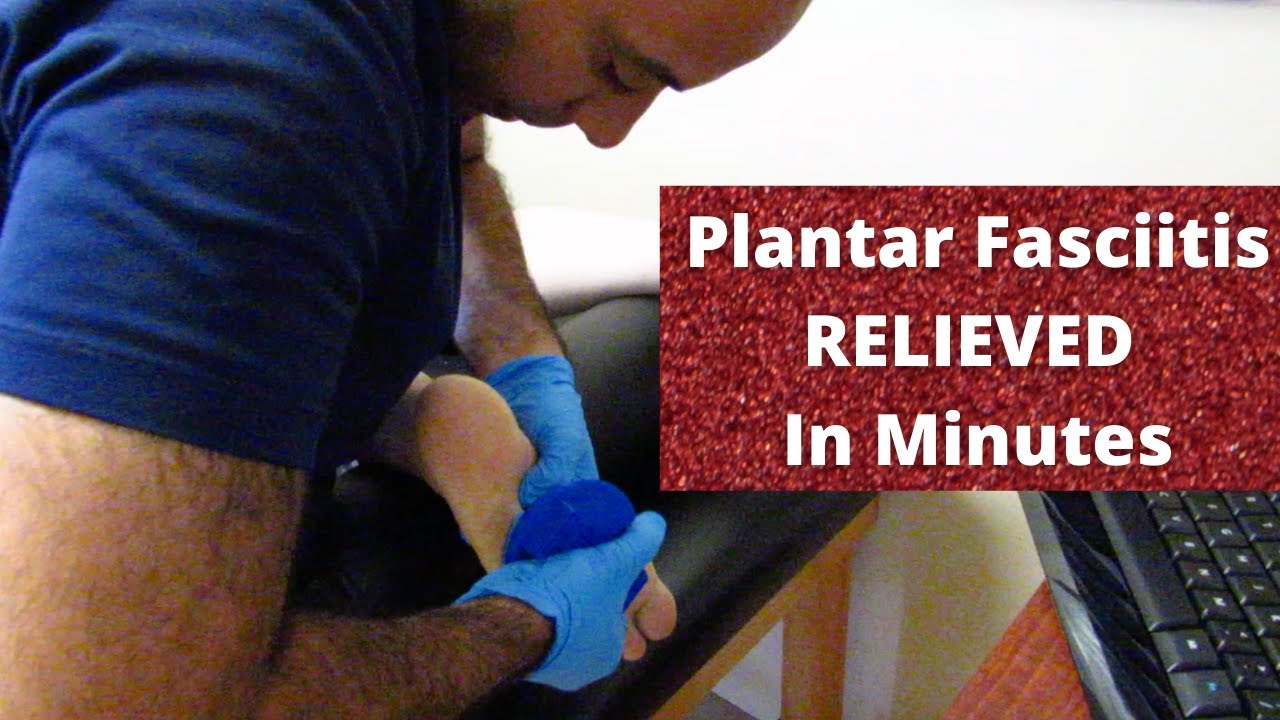 9 Months * Plantar Fasciitis * RELIEVED Before Your Eyes  (REAL TREATMENT!!!)