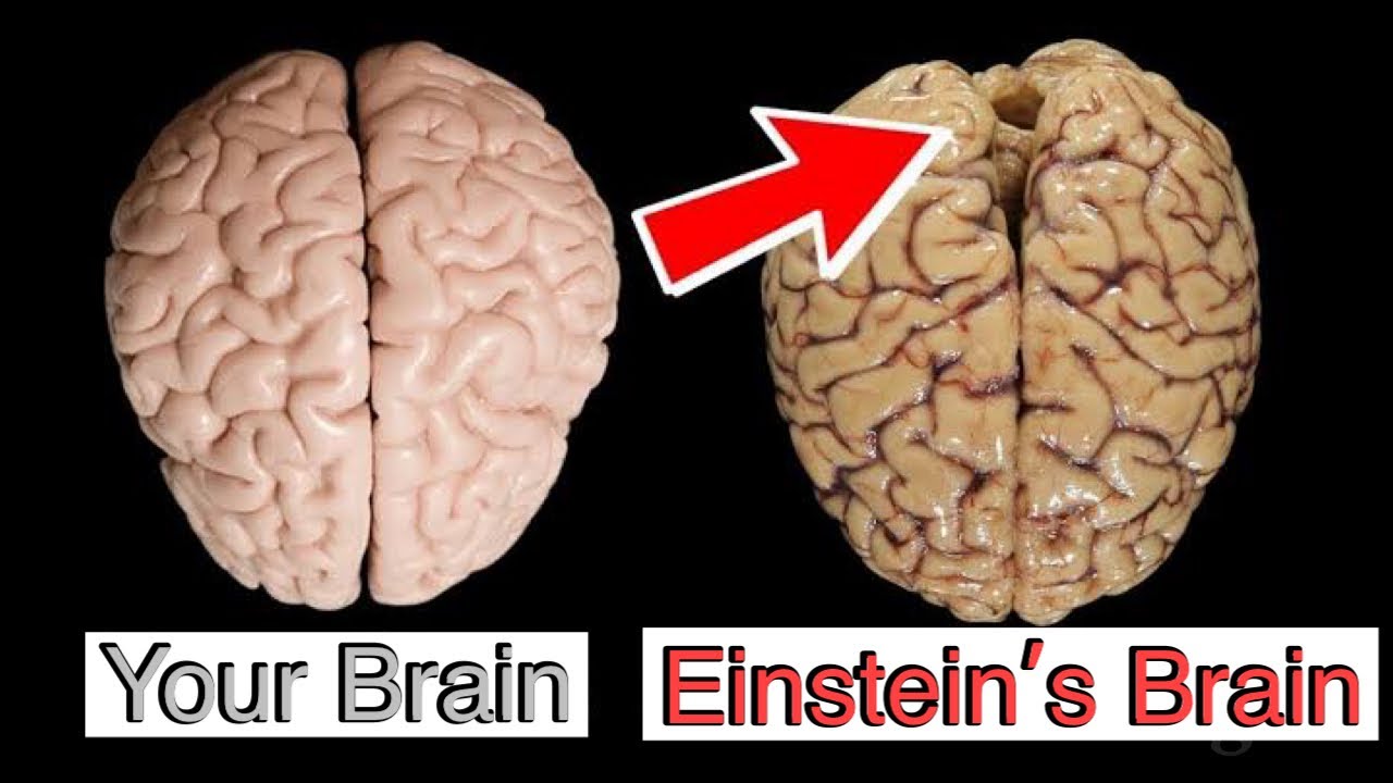 How Einstein's Brain was Different ?