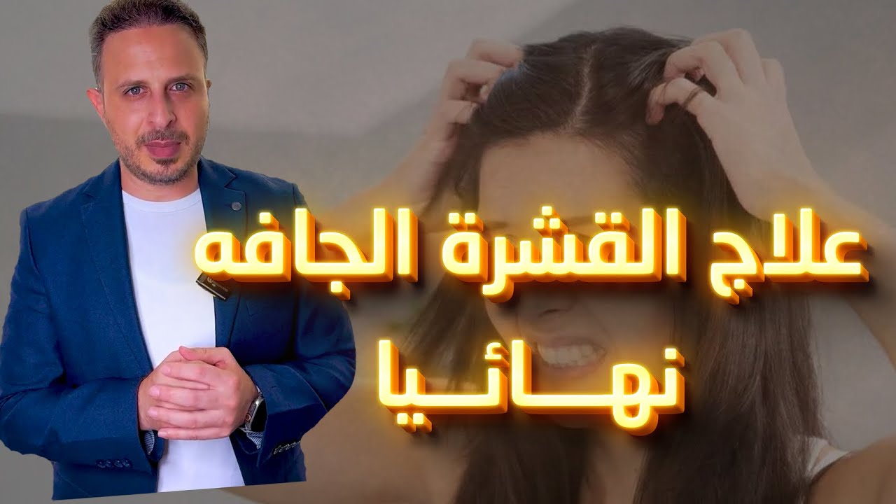 علاج القشرة الجافة المسببة لتساقط الشعر بشكل نهائي