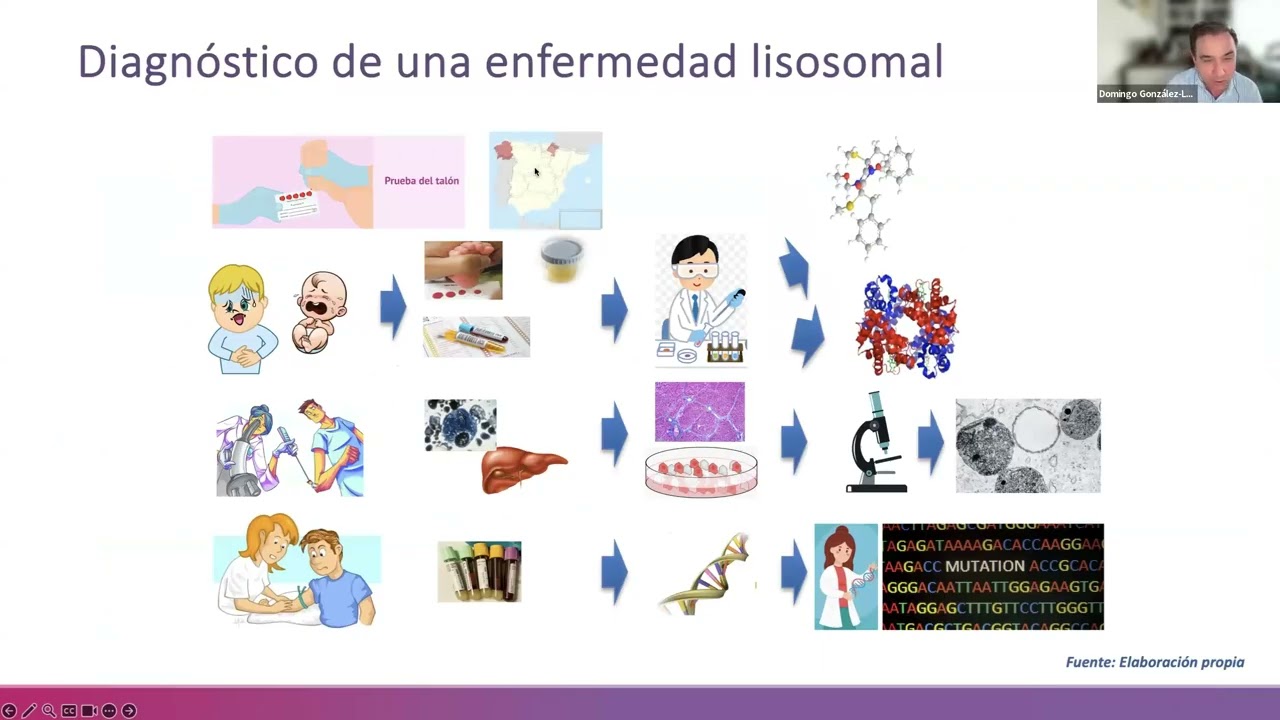 Webinar: Últimos avances en enfermedades lisosomales