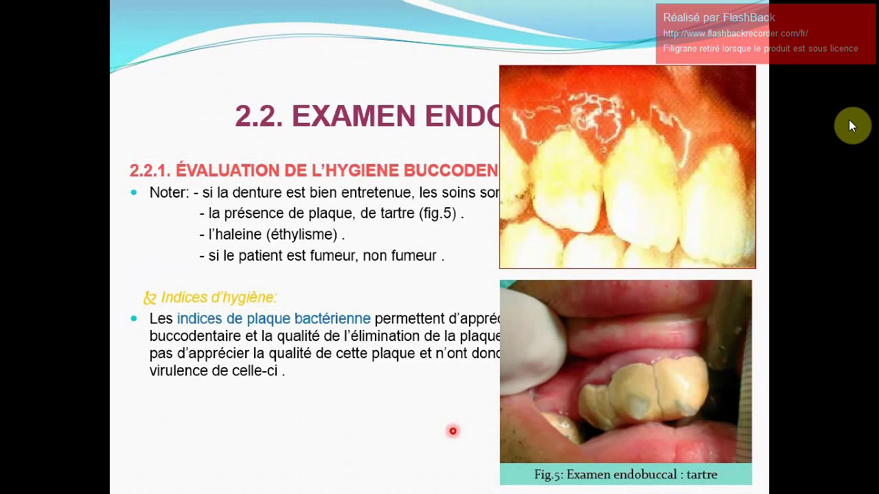 Examen endobuccal  en parodontologie 1er partie