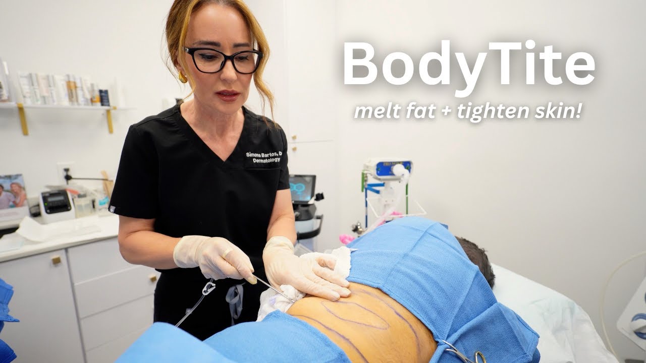 BODYTITE by InMode ✨ melt fat and tighten skin without surgery!