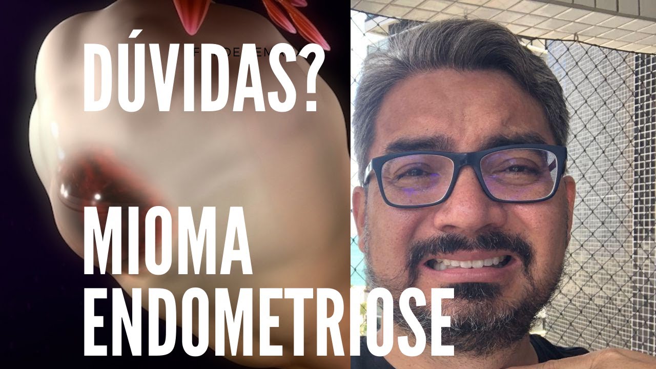 DÚVIDAS SOBRE MIOMA? ENDOMETRIOSE?