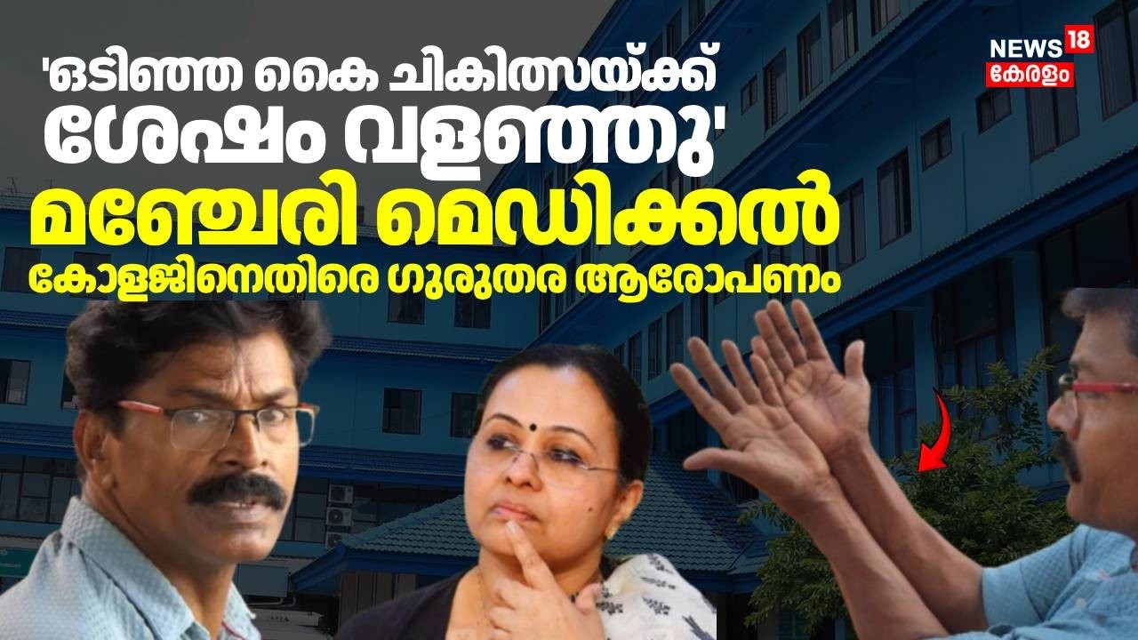 'ഒടിഞ്ഞ കൈ ചികിത്സയ്ക്ക് ശേഷം വളഞ്ഞു' മഞ്ചേരി മെഡിക്കൽ കോളജിനെതിരെ ഗുരുതര ആരോപണം | Manjeri | N18V