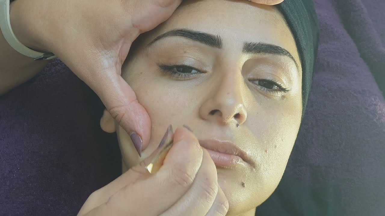 إزالة الشعر الزائد من الوجه ب(لاسيغ La cire)