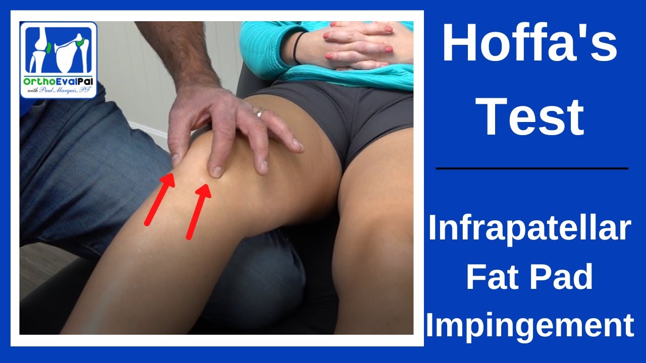Hoffa's Test for Infrapatellar Fat Pad Syndrome