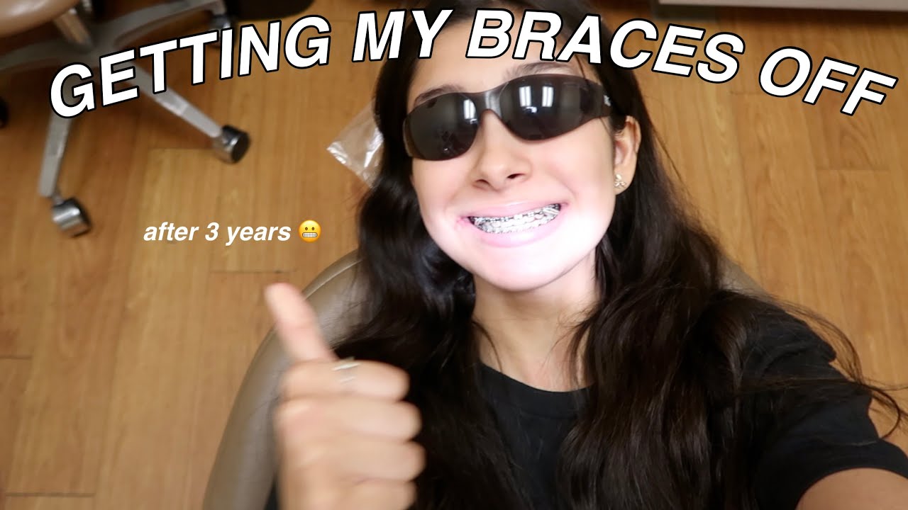 GETTING MY BRACES OFF AFTER 3 YEARS *finally*