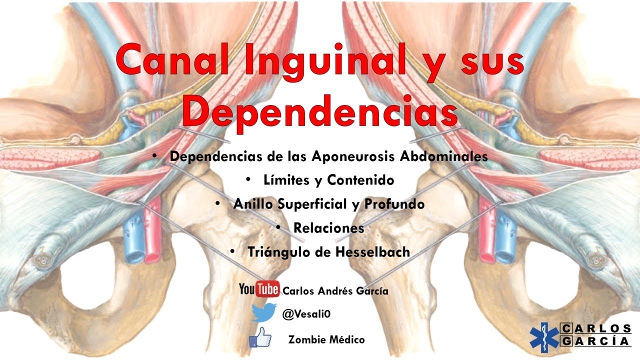 Anatomía - Canal Inguinal y Dependecias (Ligamentos Iliopectineo, Lacunar, Interfoveolar)