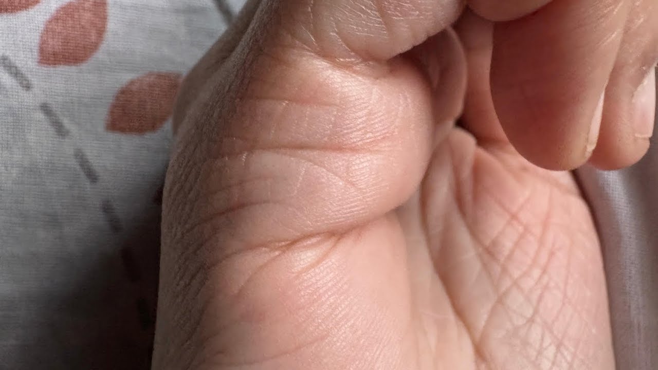 Marriage Line Palm Reading |divorce line in palm |palmistry